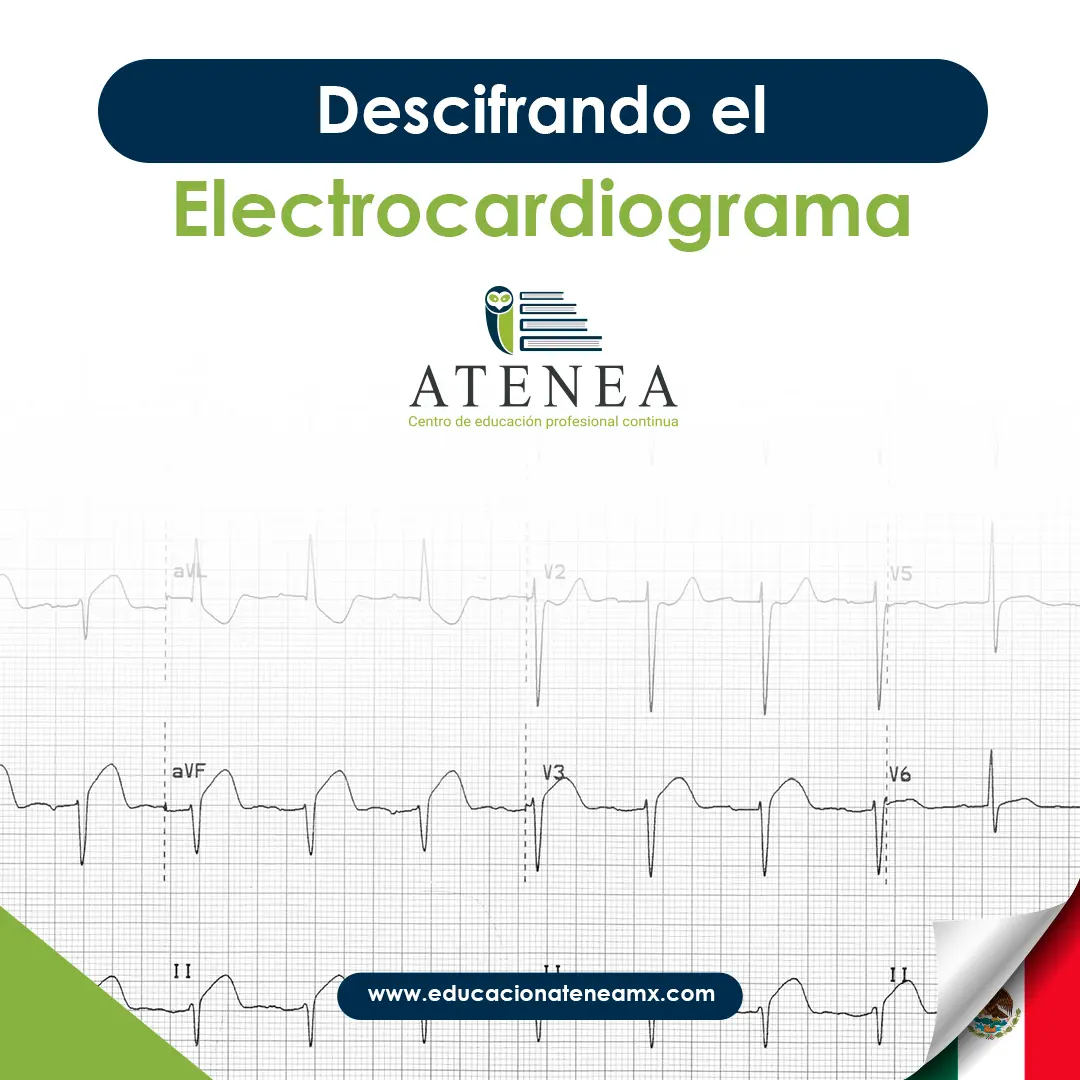 Descifrando el electrocardiograma