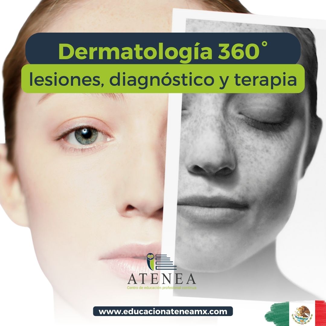 Interpretación de lesiones en Dermatología 360