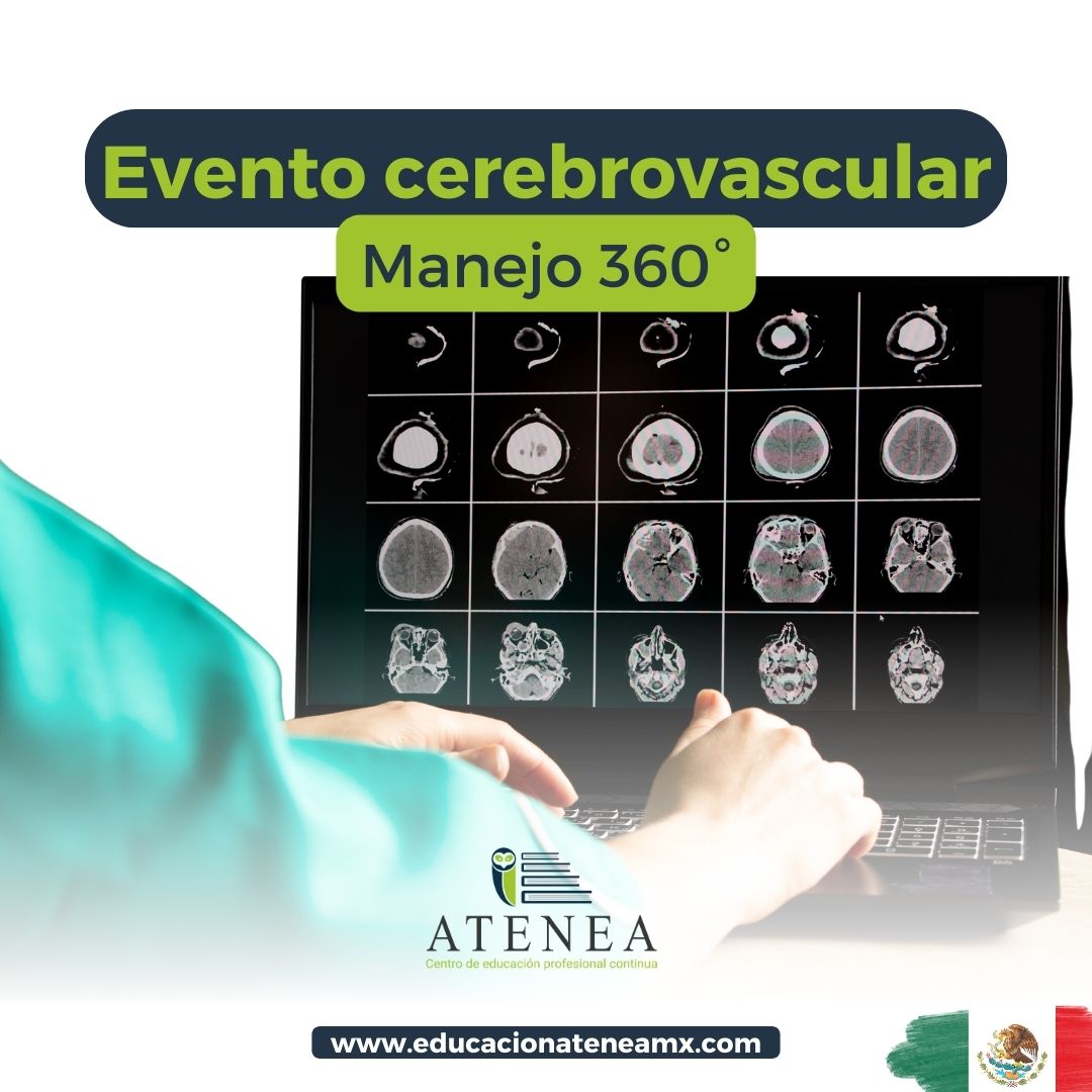 Evento cerebrovascular Manejo 360°
